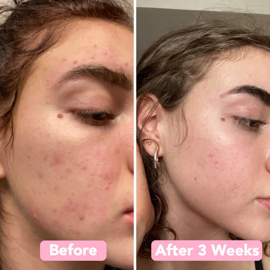 Velleara Turmeric & Kojic Foaming Cleanser