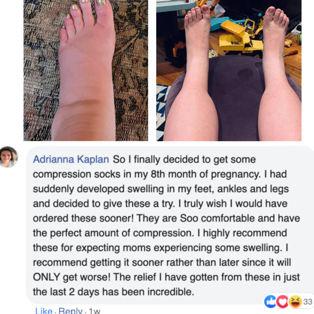 MamaFit Compression Socks